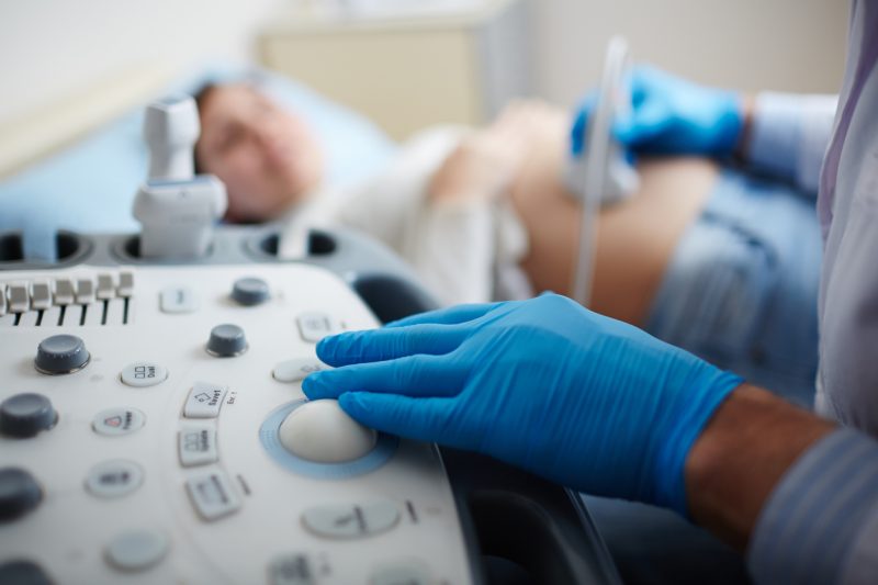 Как устроено донорство яйцеклеток в Польше. Hand of doctor in glove pressing button on panel of ultrasound equipment during regular check-up of pregnant woman