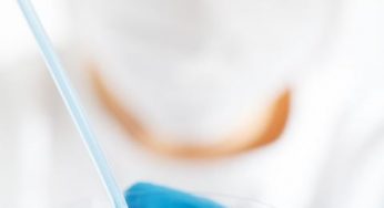 В Беларуси 440 подтвержденных случаев коронавируса. Количество увеличилось на 25% за день