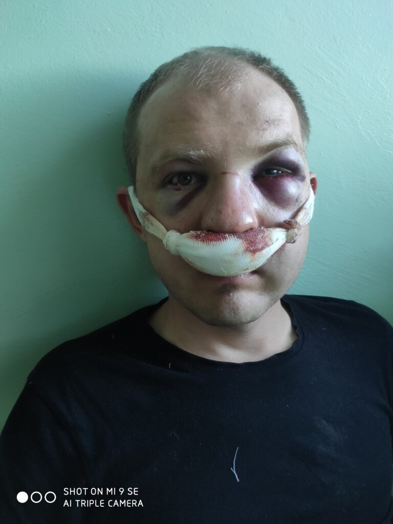 Во время протестов ОМОНовец напал на таксиста в Гродно и пострадал. Избитого гродненца могут посадить
