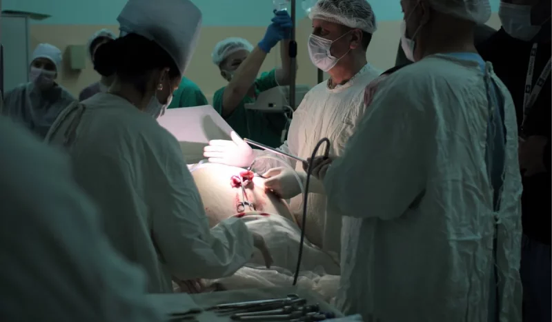 В Гродно уменьшили желудок пациенту весом 180 кг: операция прошла как мастер-класс Бариатрическая операция в Гродно