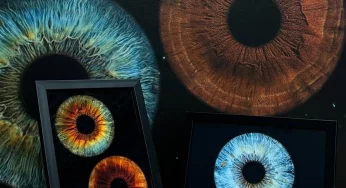 В Гродно можно сделать снимок радужки глаза — услуга нравится парам 